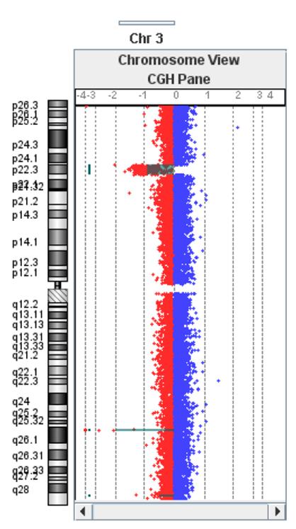 4. CRZ-004 ženska ispitanica, 9 godina. Uputna dijagnoza: RIP. Uredan nalaz GTG analize (Slika 87a.) i MLPA skrininga (subtelomere: P036 i P070; mikrodelecije P245).