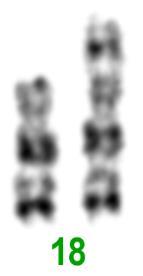 (a) Parcijalni kariotip. Kromosom 18, crvena strelica označava aberantni kromosom. (b) MLPA analiza subtelomera.