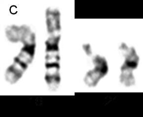 kromosome 16 i 21 (Slika 39a.).