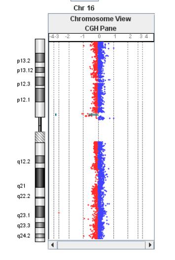 a e bf Chr Cytoband Start Stop Amplification Deletion Gene Names chr16 p11.2 32481309 33507556 0.000000-0.