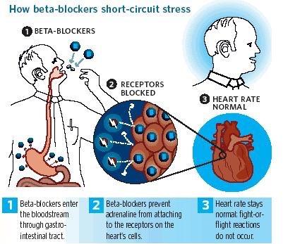 2009 American Heart Association & American College of Cardiologists suggest: Continue beta blocker for cardiac patients