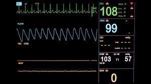 Intraoperative Considerations EKG Five Lead Blood Pressure