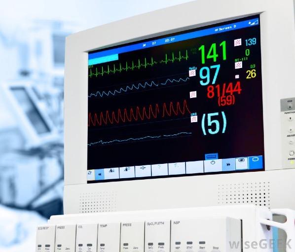 Intraoperative Monitoring Five lead EKG monitoring, ST segment analysis, pacer detection settings