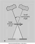 Fundamentals Panoramic Radiography: Normal
