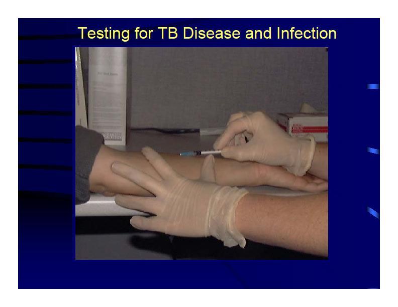 Testing for TB