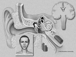 Overview of neurophysiology of the vestibular and auditory systems