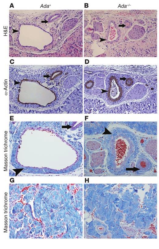 Figure 7 Ada / mice develop penile vascular damage and fibrosis subsequent to priapism. (A D) Histological examination of the vascular structures in the corpus spongiosum. (A and B) H&E staining.