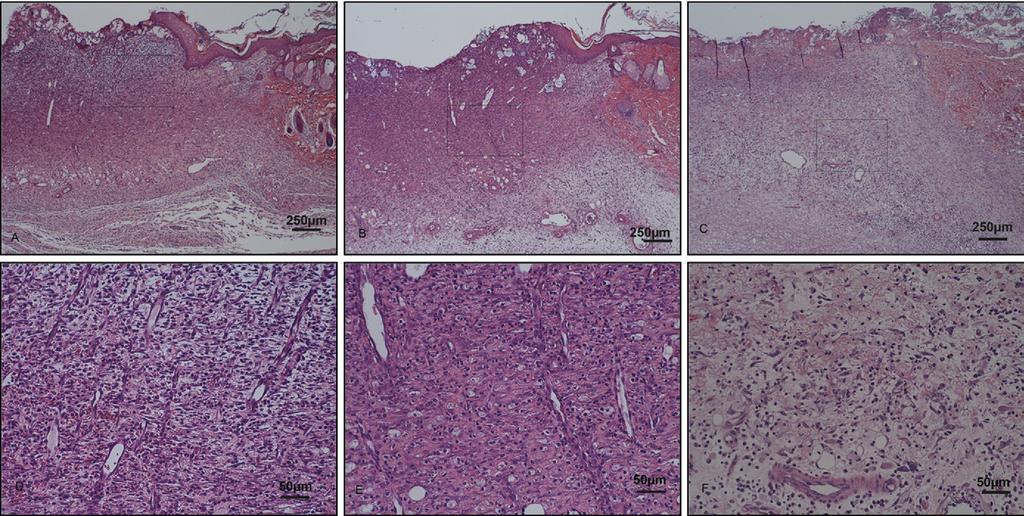 A. Atiba et al. Aloe promotes radiation-delayed wound healing 813 Figure 2 Histologic finding on day 6 postwounding. The epithelium shows creeping on (A) CG and (B) RAG, but not in (C) RA.
