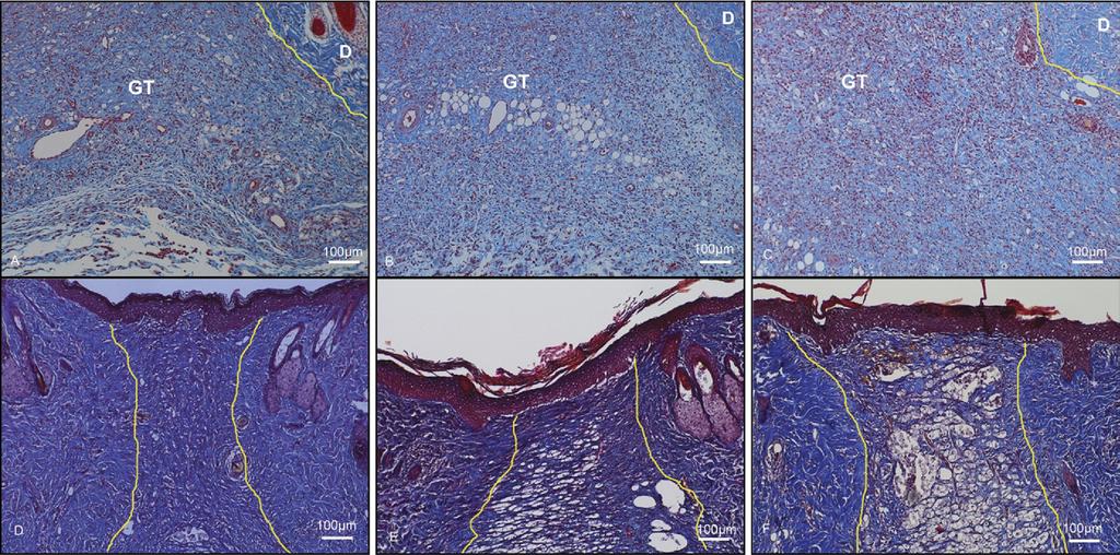 A. Atiba et al. Aloe promotes radiation-delayed wound healing 815 Figure 4 Histologic finding of the collagen deposition.