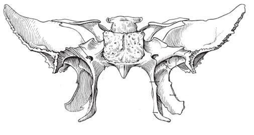 Body Lesser Wings Sphenoid Bone Greater Wing