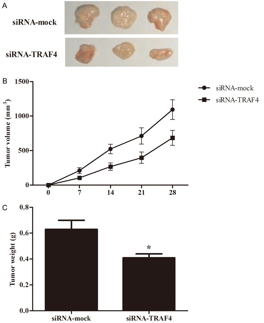 Figure 3. Knockdown of TRAF4 inhibits tumorigenicity in nude mice. A.
