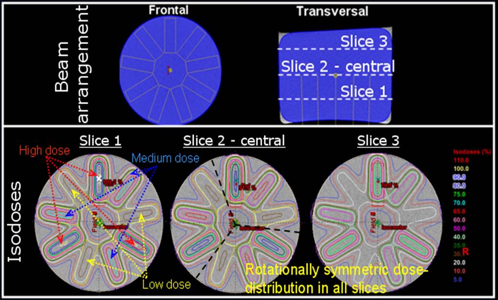 Multi-planar comparison 3 EBT films *Advances continue to be made with different 3D dosimeters.