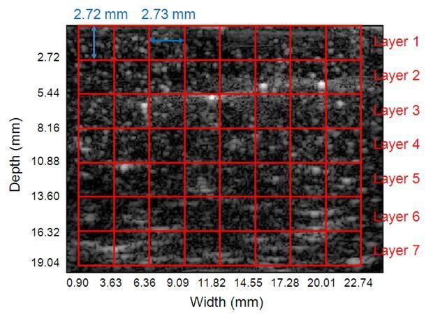 Figure 3-2. B-mode image of the tissue mimicking phantom and the 7 by 8 grid region of interest (ROI).