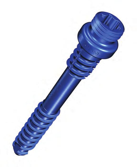 Single-Thread Screw Available in 25-45mm lengths (5mm Increments) Dual-Thread Screw Available in 30-45mm lengths (5mm Increments) 4.