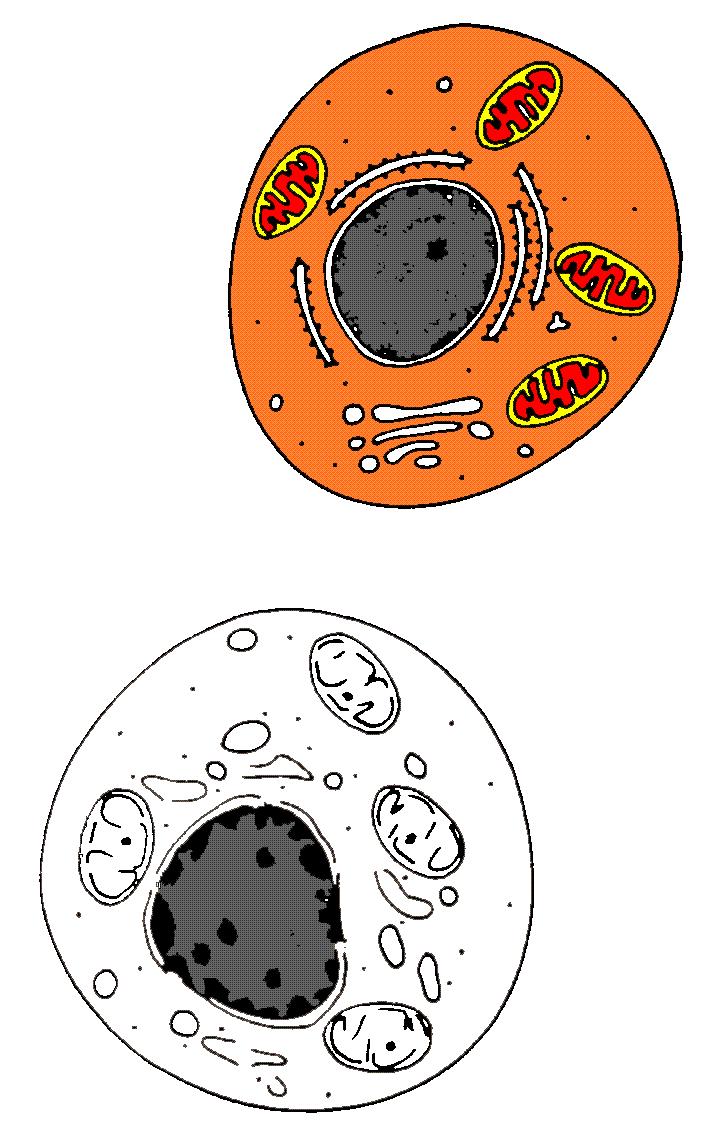 Programmed cell death - apoptosis >< necrosis