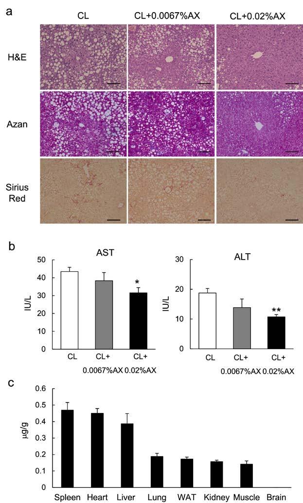 Figure S3. Dose-dependent effects of astaxanthin on the prevention of diet-induced NASH. (a) H&E, Azan, and Sirius Red-stained liver sections; scale bars = 100 μm.