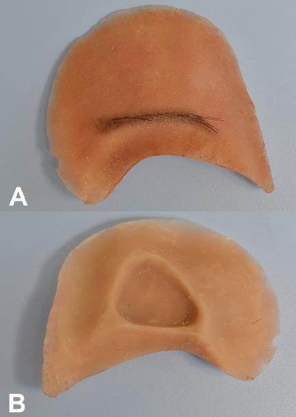 Figure 5: Silicone prosthesis following curing