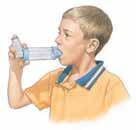 To use this inhaler, the child must be able to take a quick, deep breath. Read the package insert to learn how to use this inhaler. Make sure to check technique with the healthcare provider.
