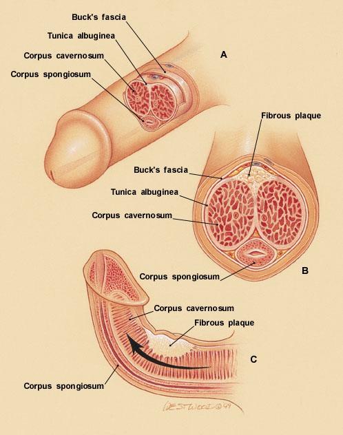 Structure of Penis Peyronies curvature 12 Structure of the Penis The shaft of the penis contains three cylindrical bodies of erectile tissue two corpora cavenosa lying parallel to each other and