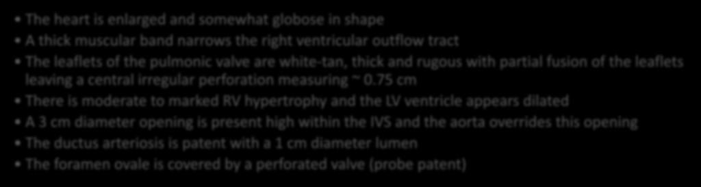 Case 6 Description The heart is enlarged and somewhat globose in shape A thick muscular band narrows the right ventricular outflow tract The leaflets of the pulmonic valve are white-tan, thick and