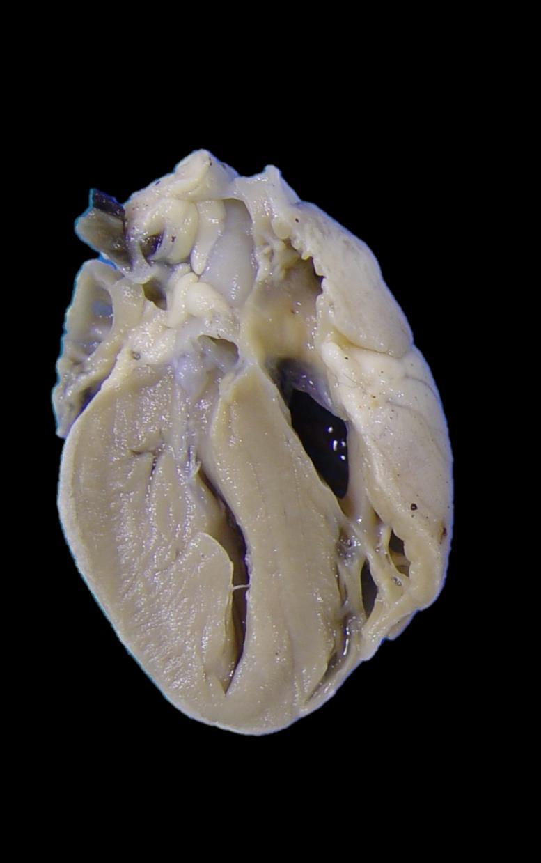 Case 1 Description Normal cat heart for