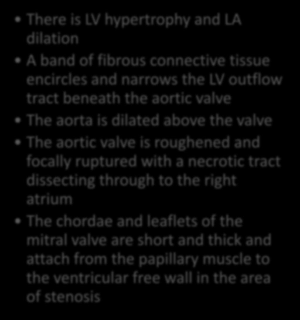 Case 2 Description There is LV hypertrophy and LA dilation A band of fibrous connective tissue encircles and narrows the LV outflow tract beneath the aortic valve The aorta is dilated above the valve