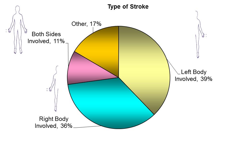 Stroke Program Information The Stroke Program at TIRR Memorial Hermann has a team of physicians, therapists, nurses, case managers and social workers dedicated to expert care of persons with stroke.