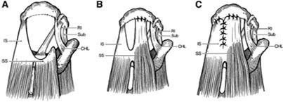 Rotator Cuff Repair Positions of significant length and tension Histology of Repair Healing Consider rotator cuff repair in primates middle aged baboons with healthy rotator