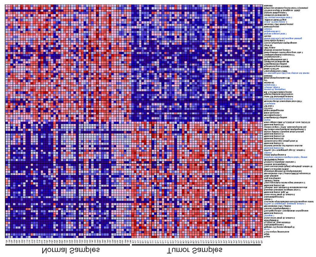 Top 50 genes with high expression in tumor along with top 50 genes with