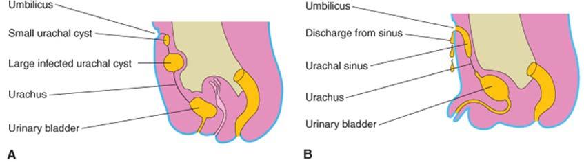 inferior part of anterior abdominal