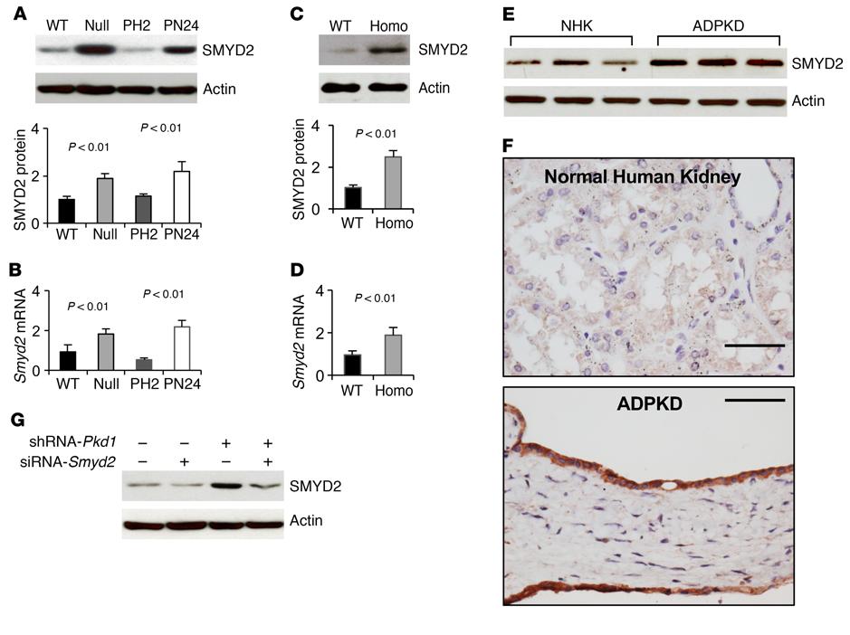 RESEARCH ARTICLE The Journal of Clinical Investigation Figure 1. Pkd1 mutant renal epithelial cells and tissues demonstrated increased expression of SMYD2.