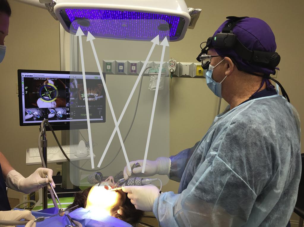 1380 IMPLANT PLACEMENT USING DYNAMIC NAVIGATION FIGURE 1. The dynamic system in use. The light source above the patient reaches the patient tracking array and the array on the handpiece.