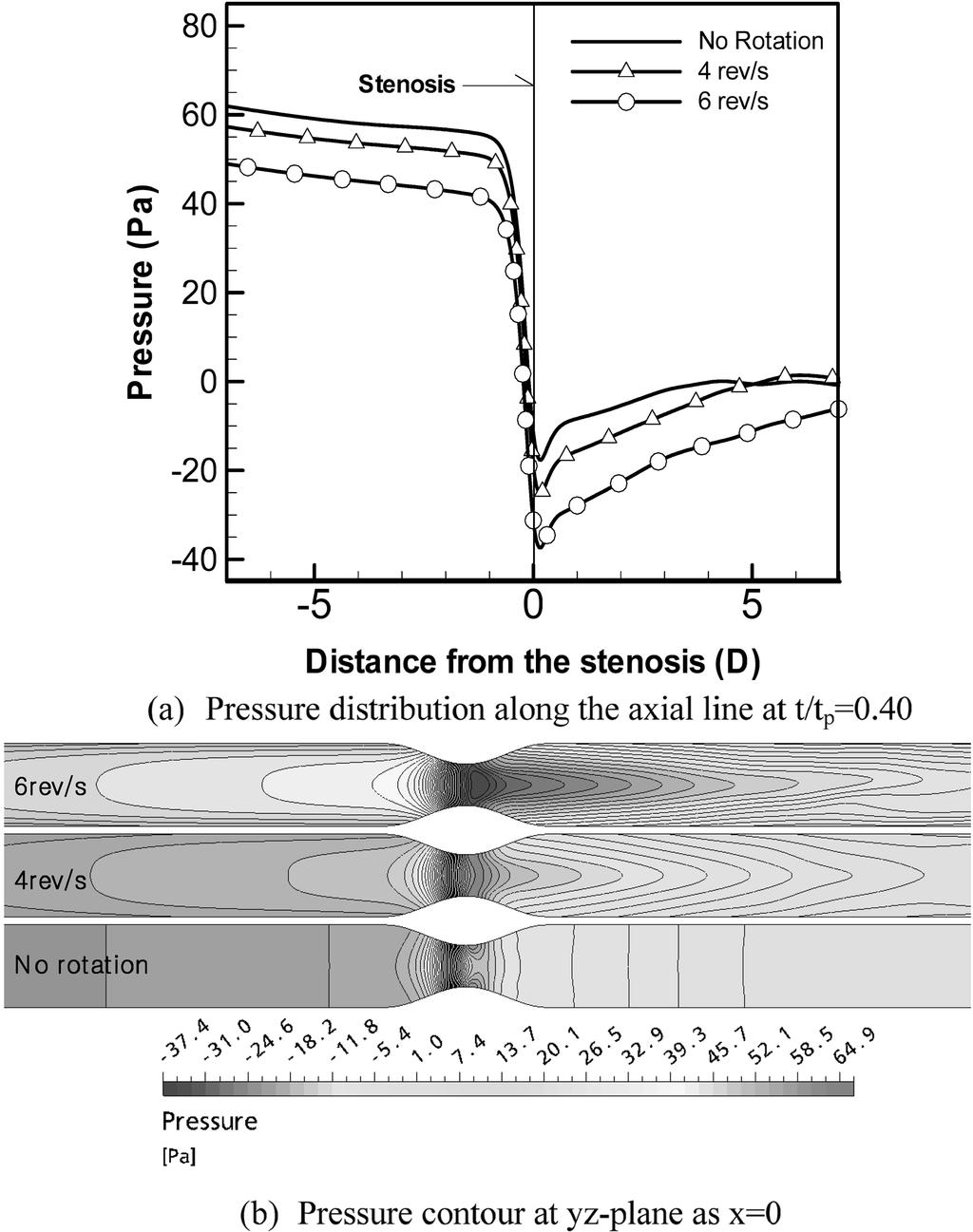 Numerical investigation on the blood flow characteristics considering the axial rotation in stenosed artery Fig. 7.