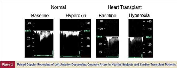 Hyperoxemia and Coronary Blood Flow McNulty PH.
