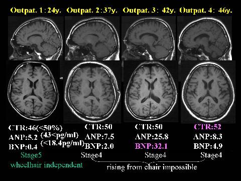 Figure 1. MRI findings.
