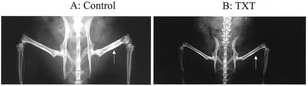 Fizazi et al: Docetaxel in Prostate Cancer Figure 1. Antitumor activity of docetaxel in a model of osteoblastic bone metastases from prostate cancer.