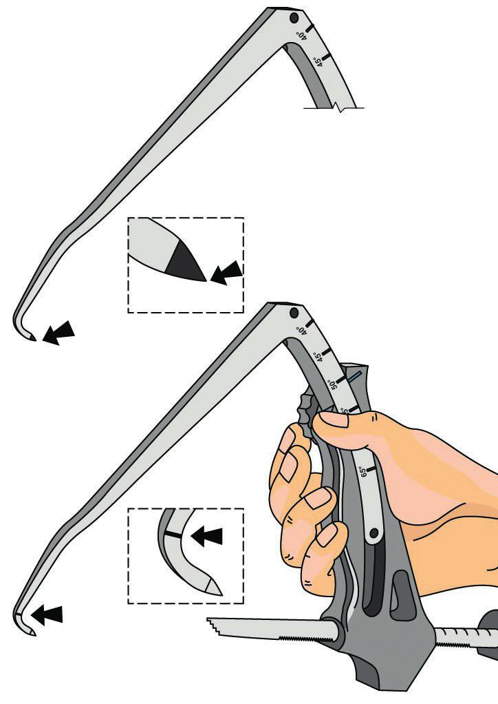 When introducing the drilling wire it comes onto the marked tip of the arm in case of the arm ACL Tip 29 2 0550.