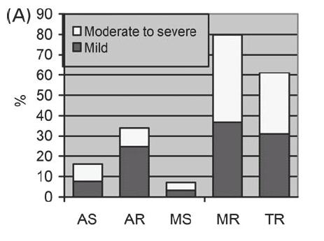Prevalence of moderate to severe FMR in acute HF EuroHeart Failure Survey II Nieminem MS Eur Heart J 2006 One