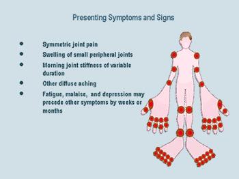 Common sites Wrists Metacarpophalangeal joints (MCPjs) Index and middle