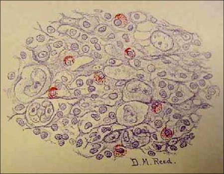 cells (Johns Hopkins Hosp Rep 1902;10:133-96) 2011