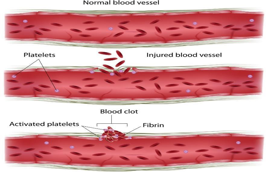 - The substances released from platelets lead to the accumulation of the platelets above each other, we call this step platelet aggregation and it s the third step -