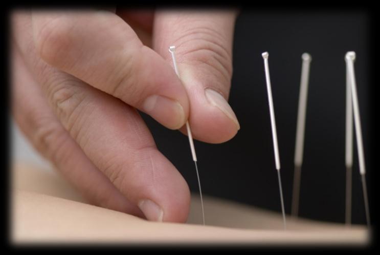 Background, originated in China, has been practiced for > 2000 years A growing evidence Acupuncture may be an effective, non-pharmacologic treatment