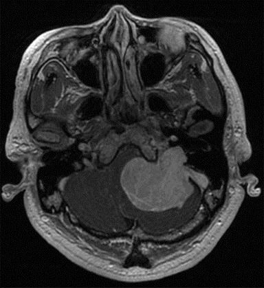 CASE 3 A 43-year-old man presented with