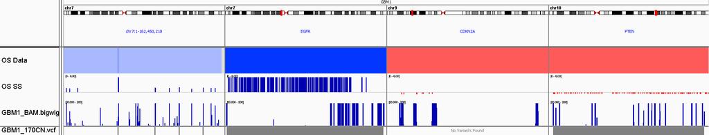 Comparison of GBM 1 WGV Regions Chr 7 EGFR CDKN2A PTEN Concordant Oncoscan Copy Number TST170 Copy Number TST170 Mutation and Fusions 7p(54.84-55.