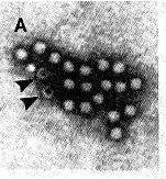 1.2 ZGRADBA Parvovirus B19 je majhen virus, velik od 18 do 25 nm. Je ikozahedralne oblike in nima ovojnice (slika 1).