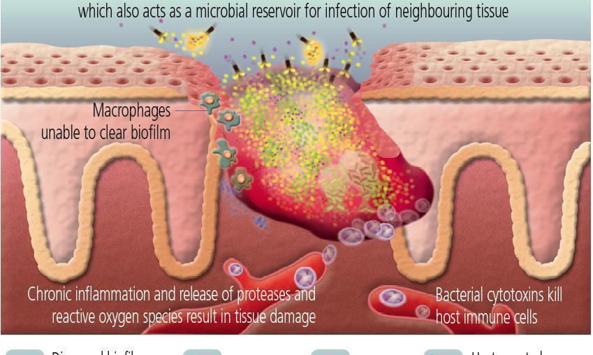 How can biofilm burden be reduced? The best methods for reducing biofilm burden are : WHY? 1. debridement (involves the removal of necrotic and contaminated tissue) EVB = C 2.