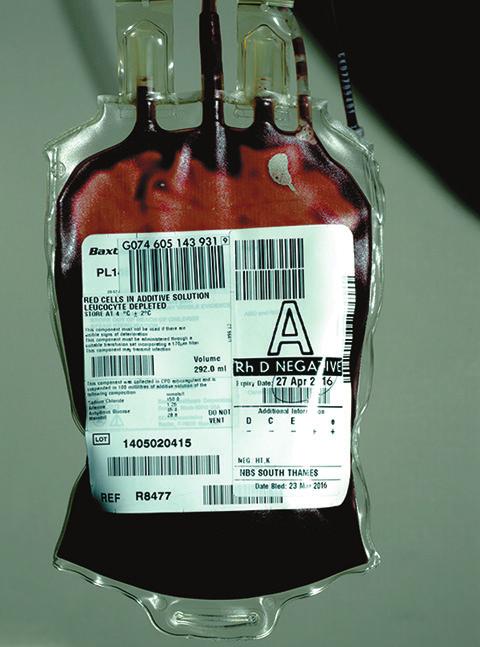 2.5 Writing Conversion Factors 45 Sample Problem 2.8 Writing Conversion Factors Identify the correct conversion factor(s) for the equality: 1 pt of blood contains 473.2 ml of blood. a. 473.2 pt 1 ml b.