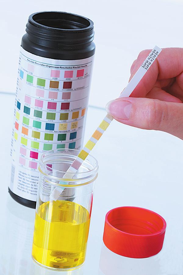 2.7 Density 59 1.000 1.010 FIGURE 2.12 A hydrometer is used to measure the specific gravity of urine, which, for adults, is 1.003 to 1.030. Q If the hydrometer reading is 1.
