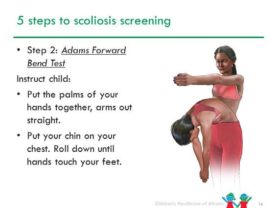 Slide 13 Observe the lateral ends (outside ends) of the clavicle. Check for shoulder height asymmetry. On the screening form, check the higher shoulder.
