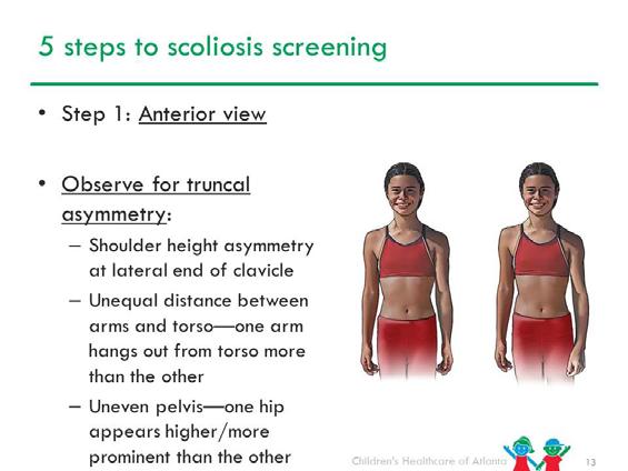 On the screening form check the side of the pelvis that appears higher. To visualize pelvic asymmetry you may ask the child to put his hands on the top of his hips.